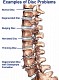 Degenerative Disc Disease